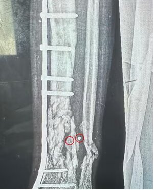 افشاگری گاردین از سلاحهای اسرائیلی که برای کشتار حداکثری ساخته شده