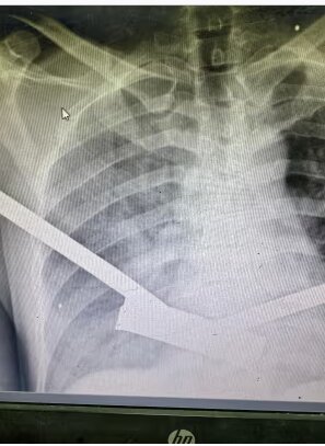 افشاگری گاردین از سلاحهای اسرائیلی که برای کشتار حداکثری ساخته شده
